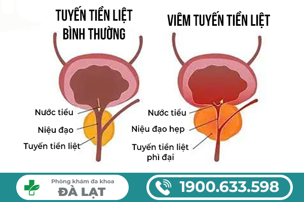 Hình ảnh minh họa